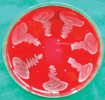 Image: Blood agar plate showing colonies of Fusobacterium nucleatum (Photo courtesy of US National Library of Medicine).